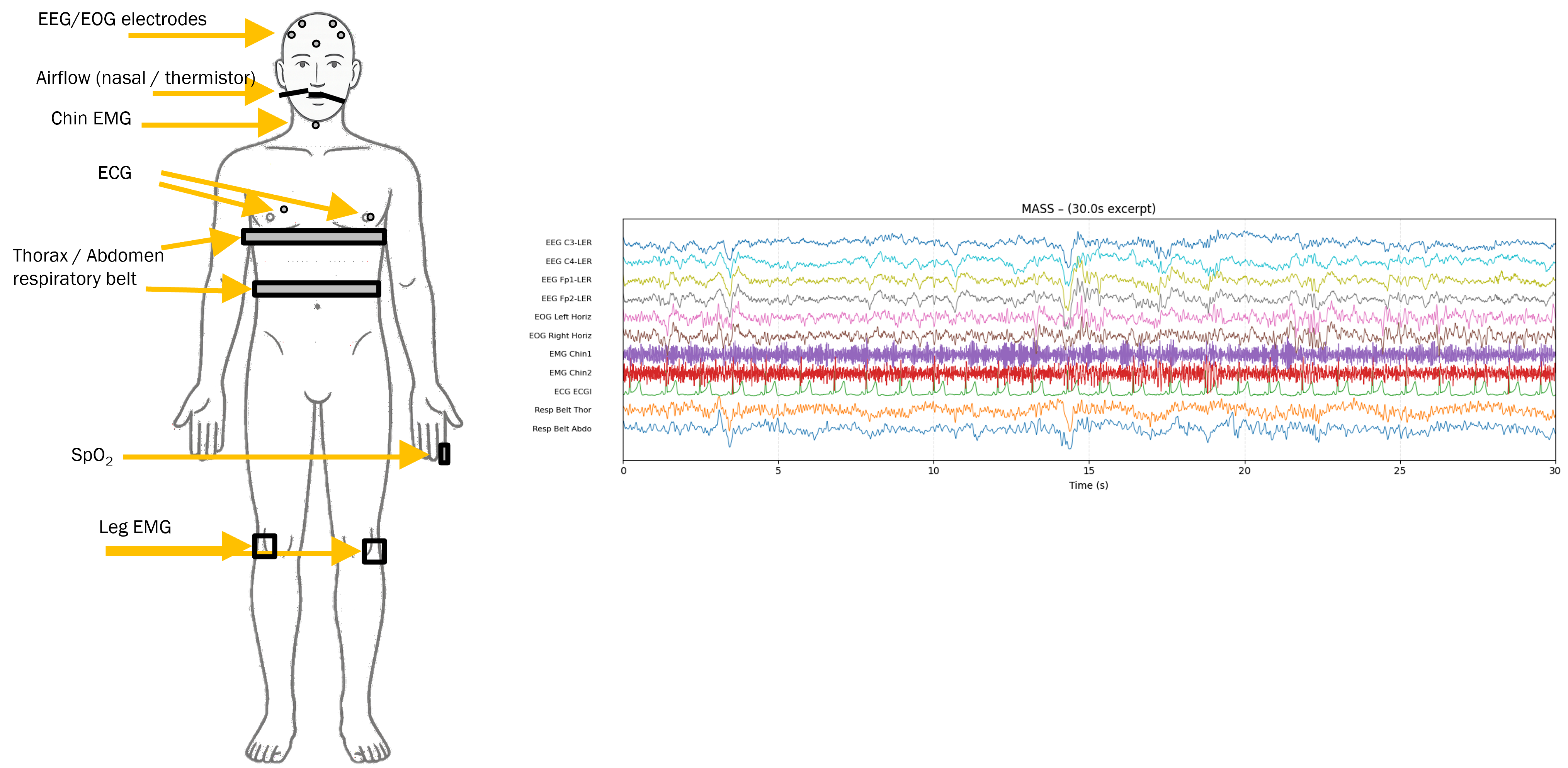 Towards Scalable Foundation Models for Sleep EEG and Polysomnography